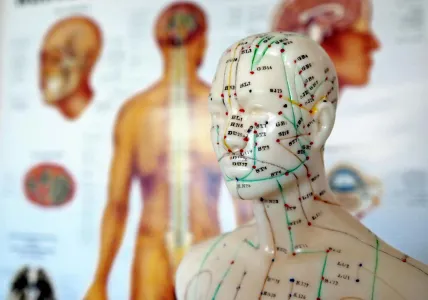 Acupression ou acupuncture ? 